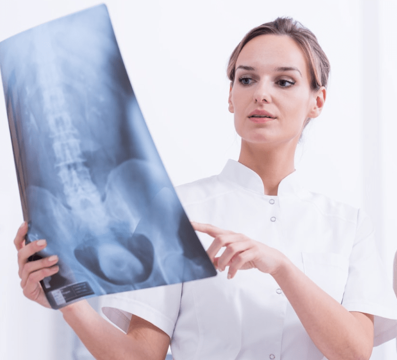 Osteokondrosi torazikoaren diagnostikoa X izpien azterketarekin